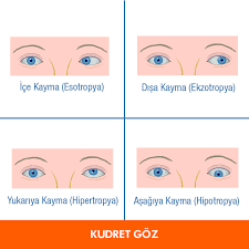 Sasiliga Genel Bir Bakis Gozler