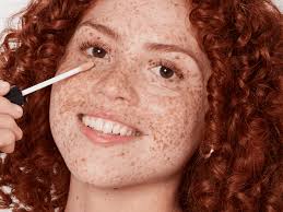 Image result for Freckled skin