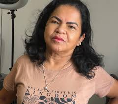 🍒Do natural ao marcante, o lábio que ganha vida com delicadeza e  intensidade na medida certa. ✨ #labioscorados #microlabial💋 #luminouslips