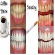 Teeth Whitening product image