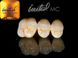 Pin De Ezginisaartdental Em Anatomi Protese Dentaria Cartao De Visita