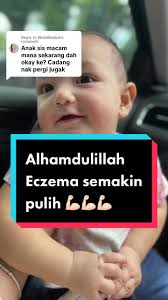 Struggle dan Jaga Ekzema: Pengalaman di Klinik Pekan Tanpa Steroid