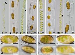 Maybe you would like to learn more about one of these? Identification Of 13 Spirogyra Species Zygnemataceae By Traits Of Sexual Reproduction Induced Under Laboratory Culture Conditions Scientific Reports