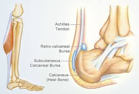 Tennis leg / plantaris tendon rupture. Achilles Tendon Human Anatomy Picture Definition Injuries Pain And More