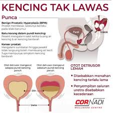 Saluran kencing manusia terdiri daripada dua bahagian iaitu Cor Nadi Punca Kencing Tak Lawas Suka Menahan Facebook