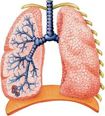 Early antibiotic treatment for pseudomonas aeruginosa eradication in patients with cystic fibrosis: Gene Therapy For Cystic Fibrosis An Example For Lung Gene Therapy Gene Therapy