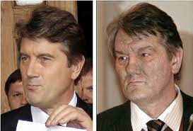 La dioxine est une substance fabriquée lors de la production de pcb. President Viktor Yushchenko Of Ukraine Before And After Dioxin Download Scientific Diagram