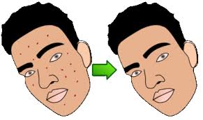 Cartoon free online photo editor. Lunapic Free Online Photo Editor Blemish Remover