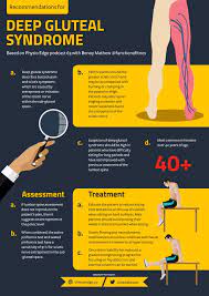 Clinical Edge Infographic Deep Gluteal Syndrome With Benoy Mathew