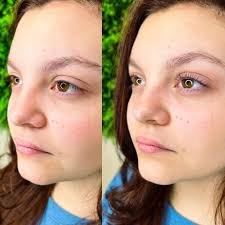 Meraki Aesthetics Bar