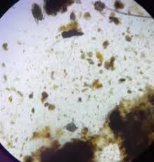 Image result for what do otodectes cynotis look like in dog fur