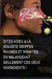 Dites Adieu A La Sinusite Grippes Rhumes Et Rhinites En Melangeant Seulement Ces Deux Ingredients Rhume Grippe Sinusite Ing Medical Vicks Vaporub Qigong