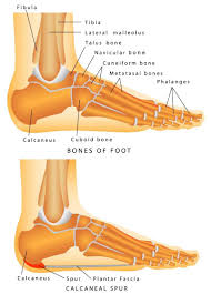 When they occur in the foot, they. Bone Spur Treatment Symptoms And Prevention Preferred Foot Ankle