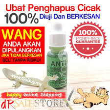 Tak perlu mengeluarkan modal banyak untuk menangkap seekor cicak. Ubat Cicak Membunuh Dan Menghalau Cicak Anti Cicak Shopee Malaysia