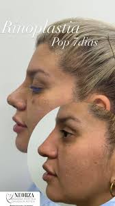 Nelson Ortiz Zarate (@dr.nelsonortiz) • Instagram photos and videos