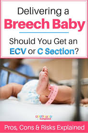 Turning A Breech Baby An External Cephalic Version Vs A C Section Breech Babies Breech Baby Exercises Transverse Baby