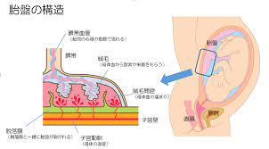 29. 胎盤梗塞 – 日本産婦人科医会