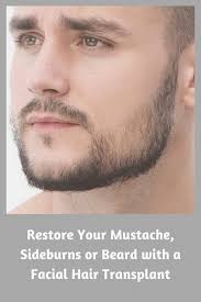 Perhaps you have made up your mind you need a facial hair transplant. Restore Your Mustache Sideburns Or Beard With A Facial Hair Transplant Hair Transplant Dubai Facial Hair Transplant Hair Transplant Hair Loss