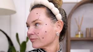 Biostimulators: How to Build Face Volume with Mayster PLLA & Gouri