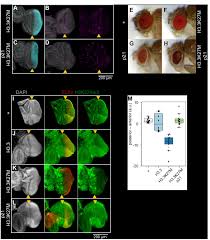 Schedule an appointment with us today. Histone Deposition Pathways Determine The Chromatin Landscapes Of H3 1 And H3 3 K27m Oncohistones Elife