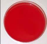Principles and explanation of the procedure microbiological method. Cna Blood Agar Flashcards Quizlet