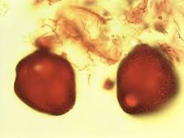 Image result for Rytigynia