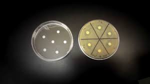 Antimicrobial activity was observed for all the three silver doping concentrations with the highest activity for x = 3, in terms of the zone of inhibition and the percentage reduction in the the hemolytic activity of the samples was investigated according to the method described by parnham, yinghui et al. Testing An Antibiotic Using A Disk Diffusion Assay Kirby Bauer Method Youtube