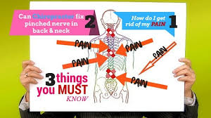 Maybe you would like to learn more about one of these? Can A Chiropractor Fix A Pinched Nerve 3 Steps You Must Do Stayfit Yung