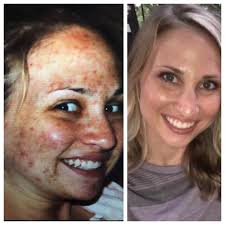 Candice Carroll, Rodan + Fields Independent Consultant