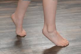 Sensitive knees can benefit from walking. Common Foot Problems In Children Foot And Ankle