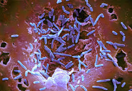 Without treatment, the fever lasts for about a month and as many as. Puppies Food Salmonella Symptoms Treatment