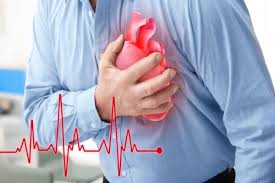 O diagnóstico de ecg do infarto do miocárdio é mais difícil se houver um bloqueio do ramo do feixe esquerdo, já que os dados do ecg se assemelham às mudanças. Infarto Como Ocorre Tratamento Grupos De Risco Brasil Escola