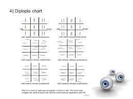 57 True To Life Diplopia Chart
