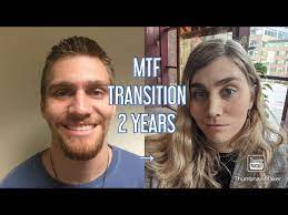 This was a very emotional video for me to this is my story about my transition as a transgender woman (mtf). My Transition Timeline 2 Years Hrt Ffs Rgr Youtube