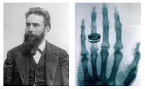 Radiologists will spend the first year of their residency practicing general medicine and surgery, and their remaining years focusing on radiology. The Future Of Radiology And Artificial Intelligence The Medical Futurist