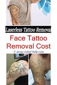 How To Remove Metallic Tattoos How Expensive Is Tattoo Removal Did Christina Perri Have Her Tattoos Rem Tattoo Removal Cost Laser Tattoo Removal Tattoo Removal