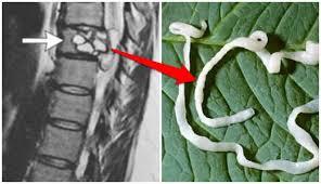 Kurangnya menjaga kebersihan dapat menjadi salah satu pemicunya. Badan Seperti Tersengat Listrik Waspada Bisa Jadi Cacing Pita Bersarang Di Tubuhmu Boombastis
