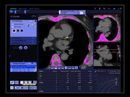 You'll perform scans on all parts of the body for a variety of reasons. Syngo Via