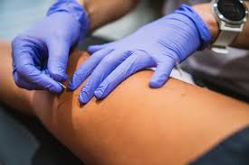 Salt lake city ut stands at number 9 in the list of cities with most expensive car insurance rates in utah with a indexing difference of $543. Dry Needling Grassroots Physical Therapy