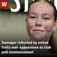 We all stand with Skye today ❤️