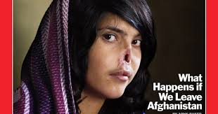 Disfigured Afghan teen to have surgery in US