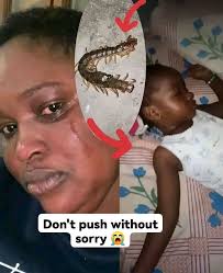 16 16+2x4 4 +2x 72-1124 72 24 โนม