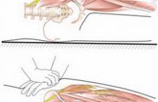 Image result for Pelvic Compression Test