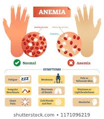 Anemia Images Stock Photos Vectors Shutterstock
