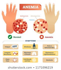 anemia images stock photos vectors shutterstock