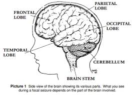 A febrile seizure is a convulsion (uncontrolled shaking) caused by a fever of 100.4°f (38°c) or higher. Focal Seizures Partial Symptoms And When To Get Emergency Help