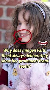 Imogen Fairg Reid Teeth