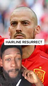 Prime David Silva Hairline Resurrection