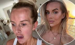 Love Island's Faye Winter bravely opens up