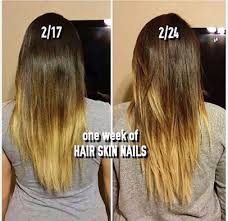 Don't forget to subscribe!music provided by. Nature S Bounty Hair Skin And Nails Reviews Google Search Hair Skin Nails Lost Hair Hair Skin